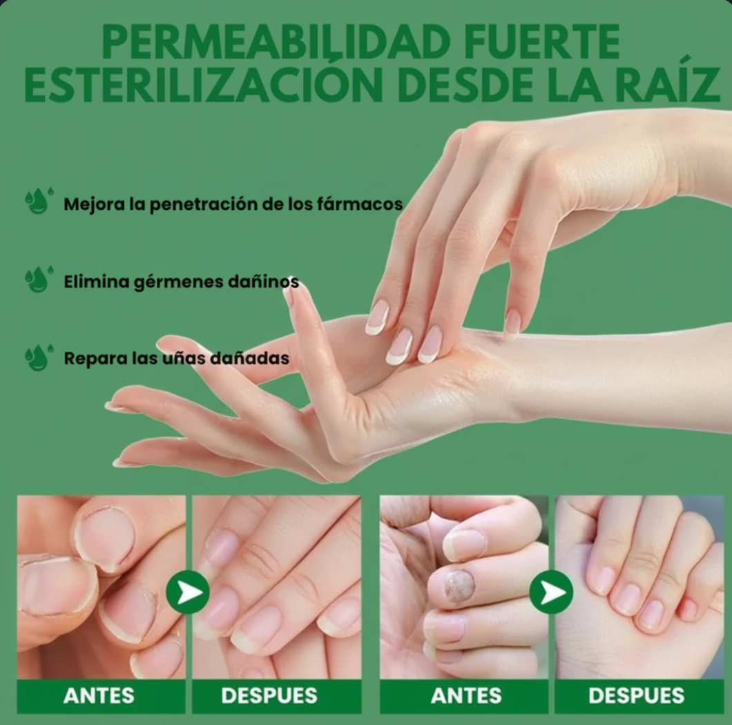 Vuelve amar tus uñas con nuestro serúm