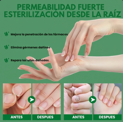 Vuelve amar tus uñas con nuestro serúm
