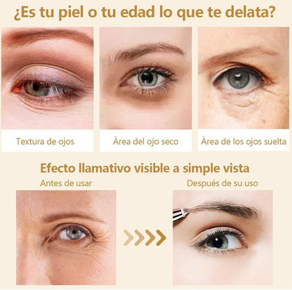 El tratamiento dorado para una mirada sin signos de fatiga