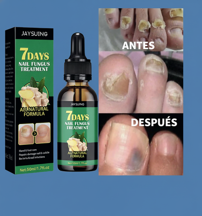 Vuelve amar tus uñas con nuestro serúm